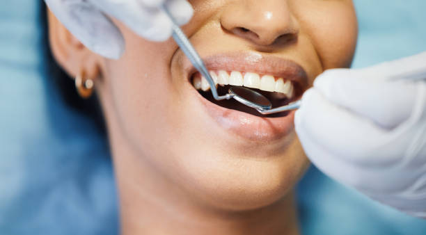 Best Knocked-Out Tooth (Avulsed Tooth) Treatment in Yorktown, IN